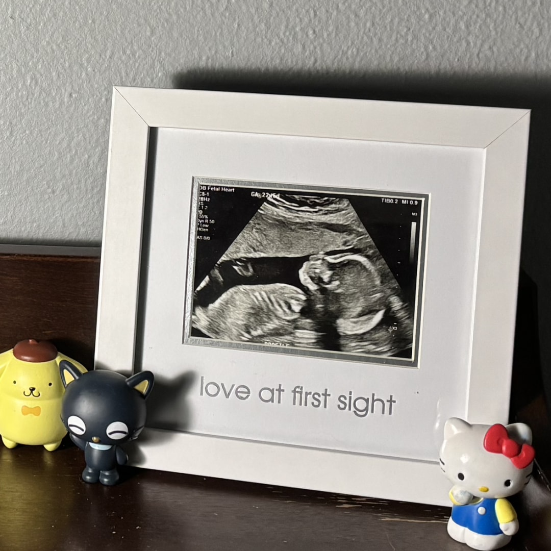 Photo shared by Lindsey for their Babylist baby registry.