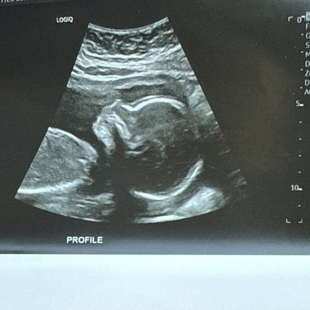 Photo shared by Cassie for their Babylist baby registry.