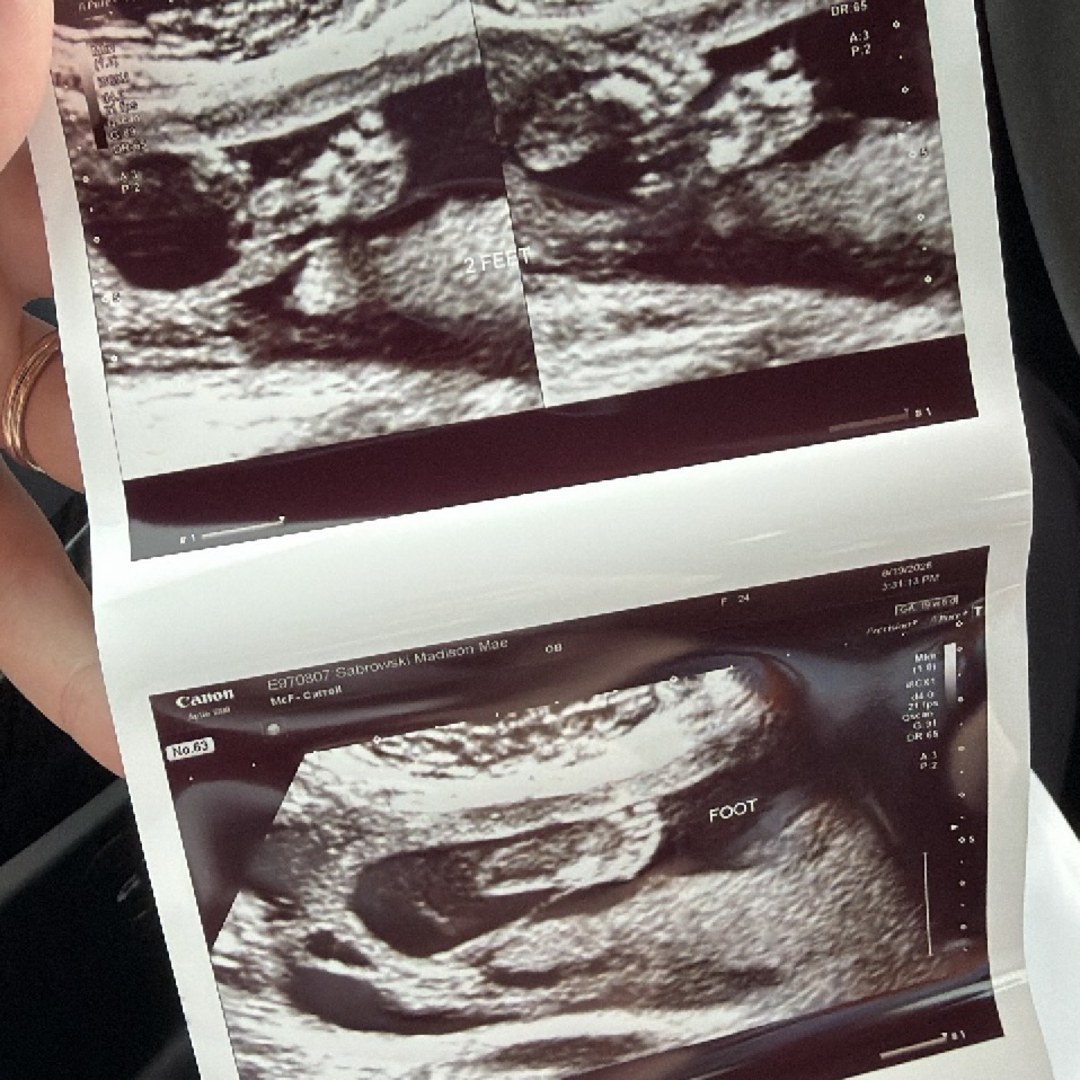 Photo shared by Madison for their Babylist baby registry.