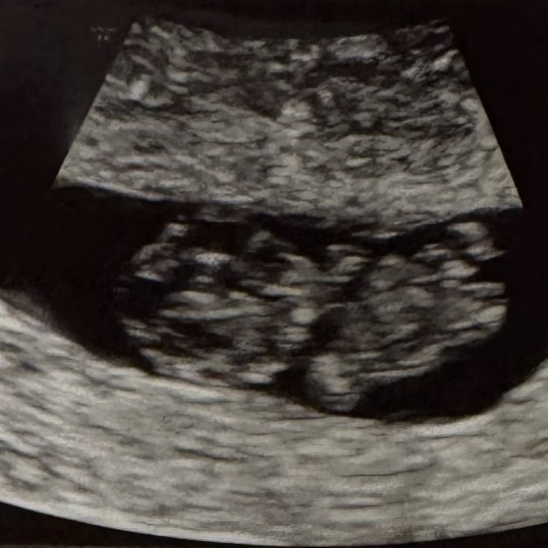 Photo shared by Taylor for their Babylist baby registry.