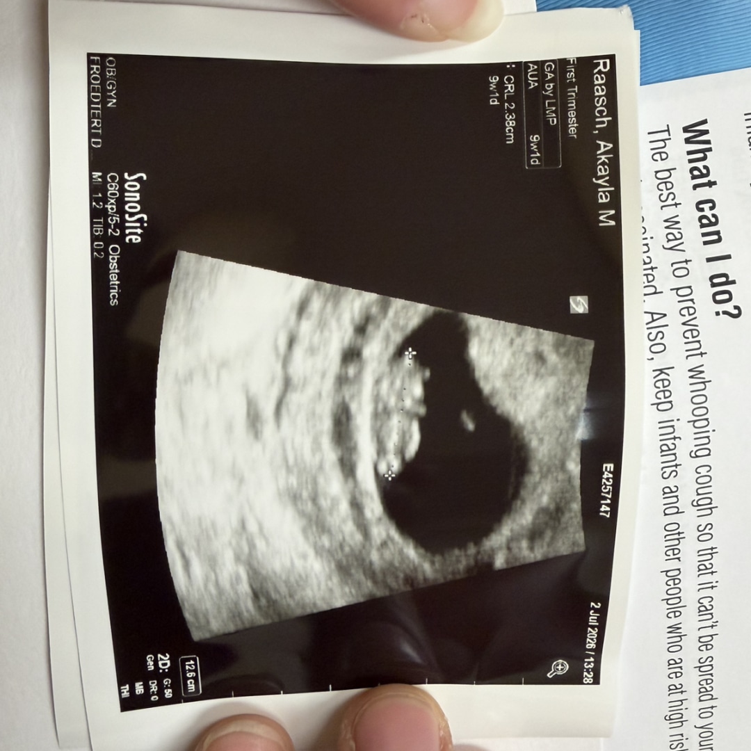 Photo shared by Akayla for their Babylist baby registry.