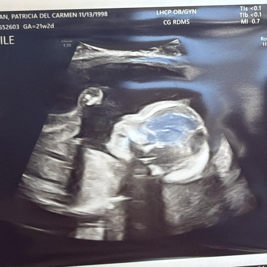 Photo shared by Patricia for their Babylist baby registry.