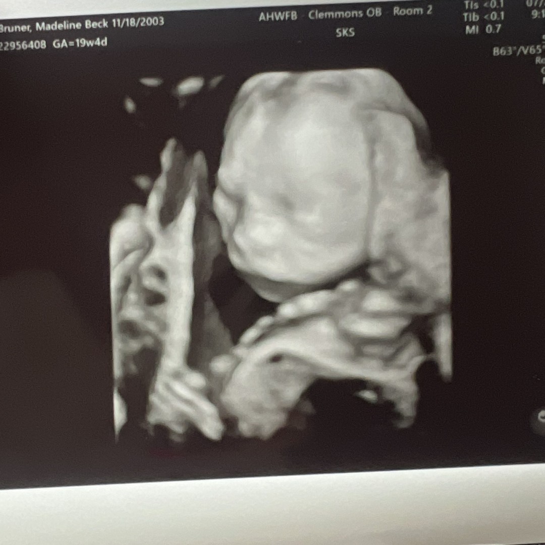 Photo shared by Mattie for their Babylist baby registry.