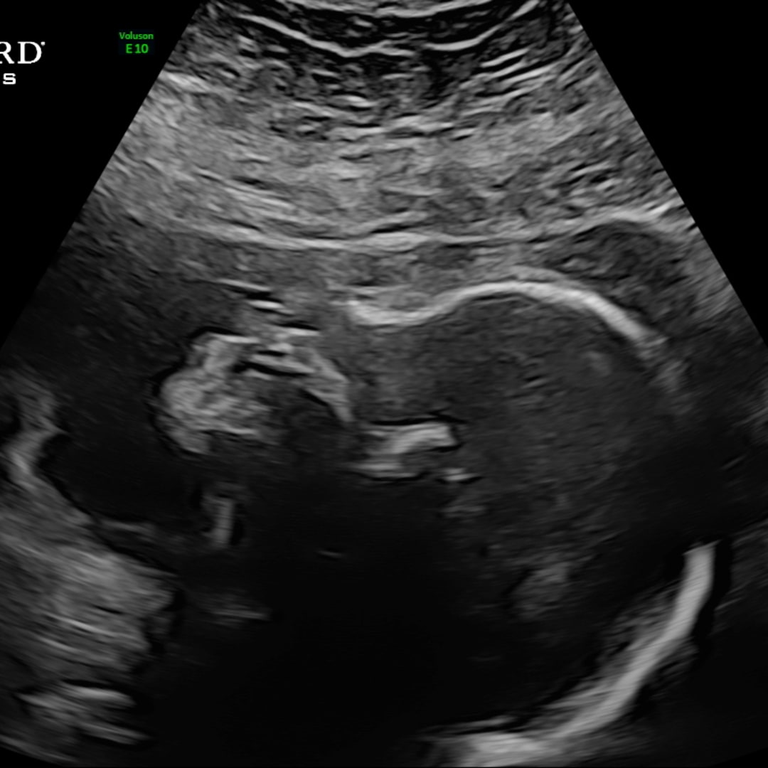 Photo shared by Jasmine for their Babylist baby registry.