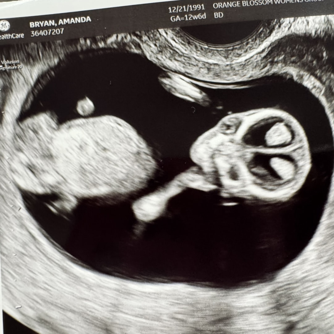 Photo shared by Amanda for their Babylist baby registry.