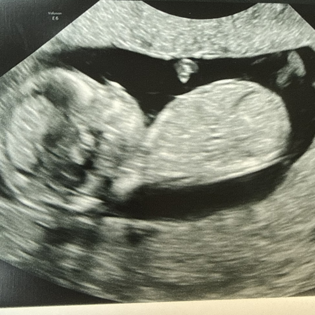 Photo shared by Amanda for their Babylist baby registry.