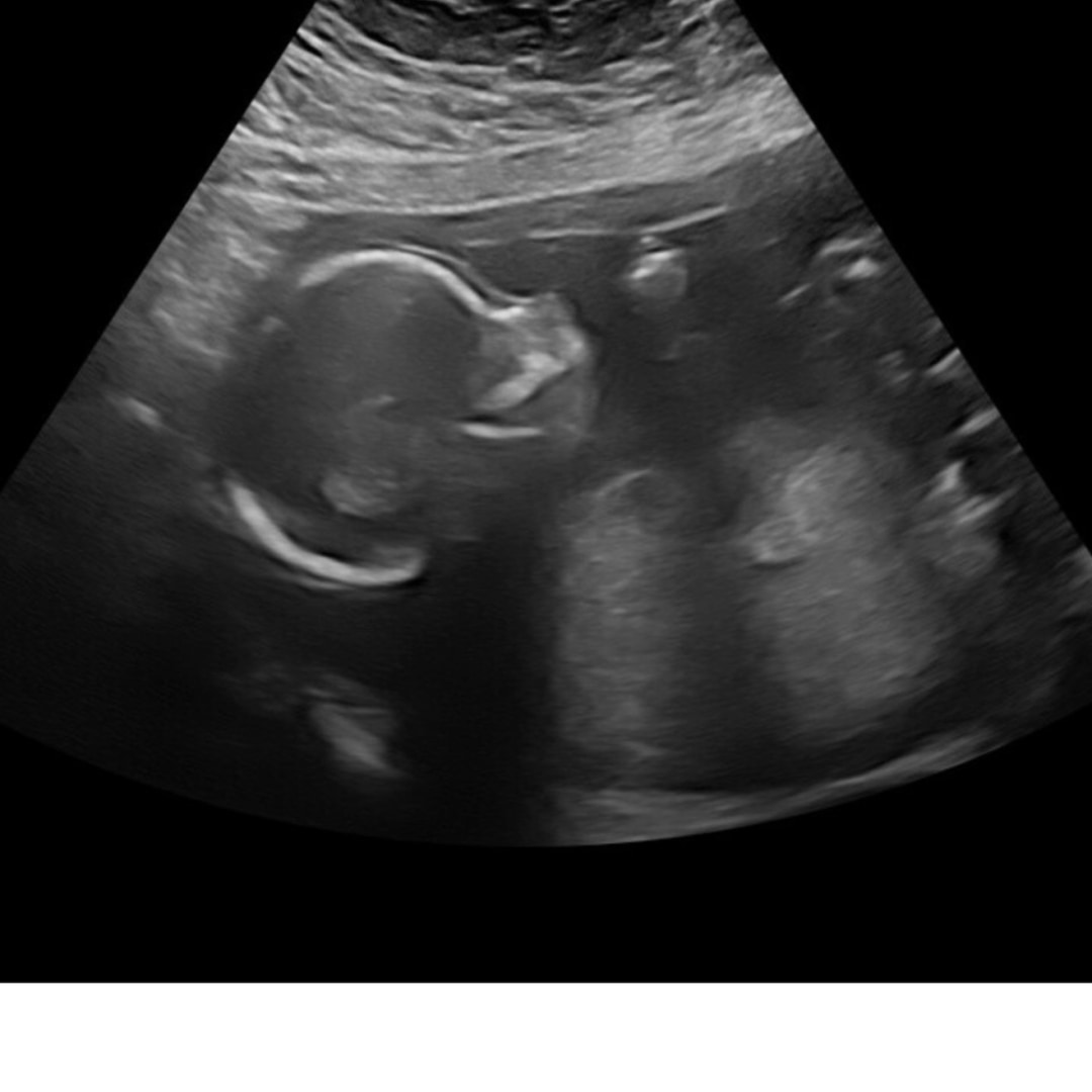 Photo shared by Abbey for their Babylist baby registry.