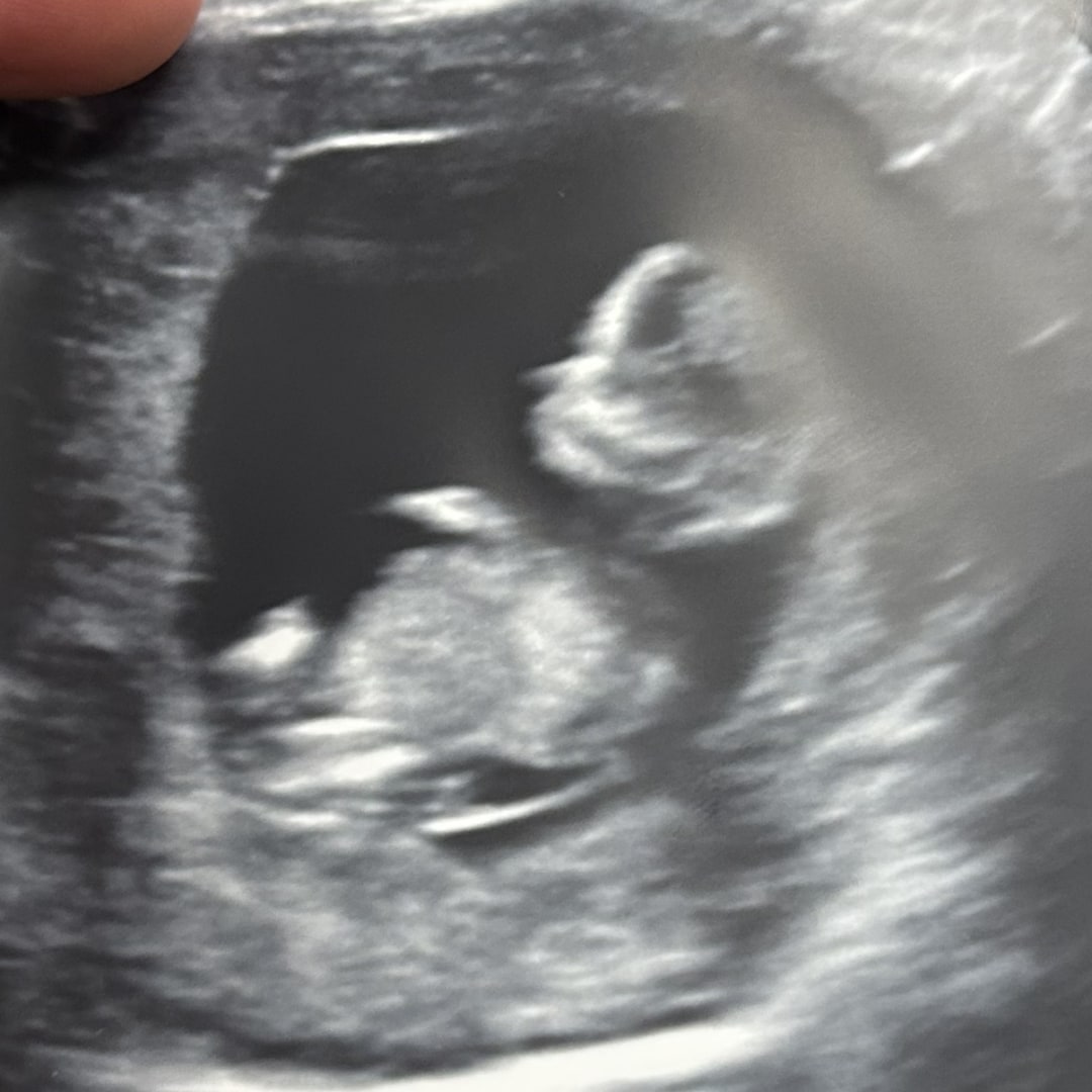 Photo shared by Desiree for their Babylist baby registry.