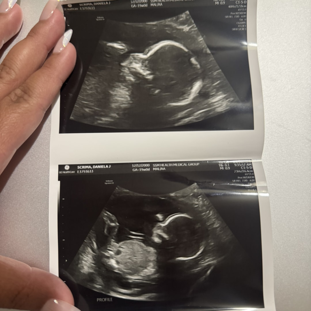 Photo shared by Daniela Joy for their Babylist baby registry.