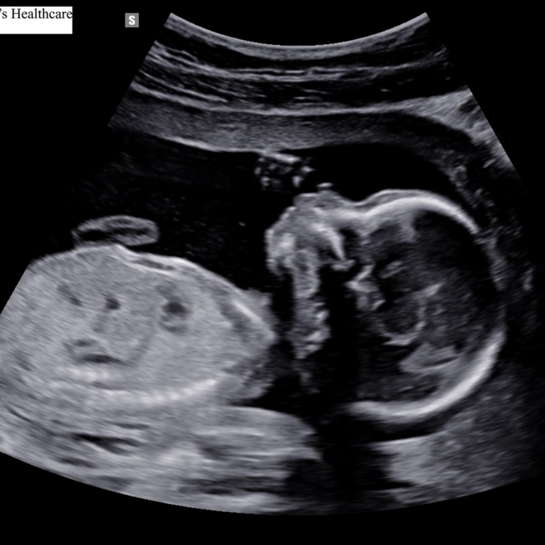Photo shared by Alyssa for their Babylist baby registry.