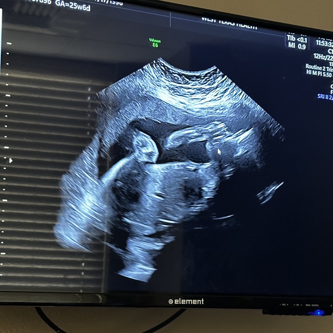 Photo shared by Kierra for their Babylist baby registry.