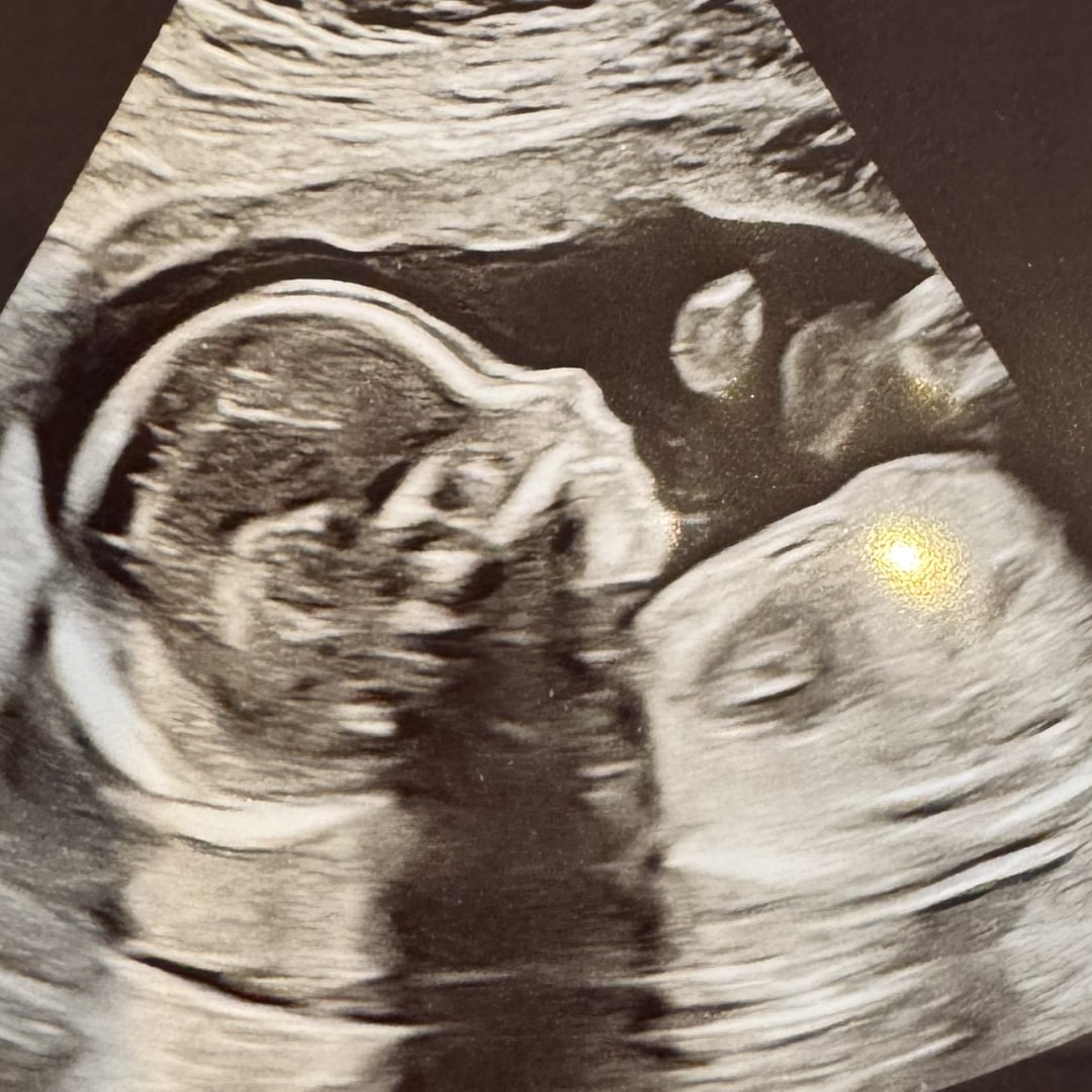 Photo shared by Amanda for their Babylist baby registry.