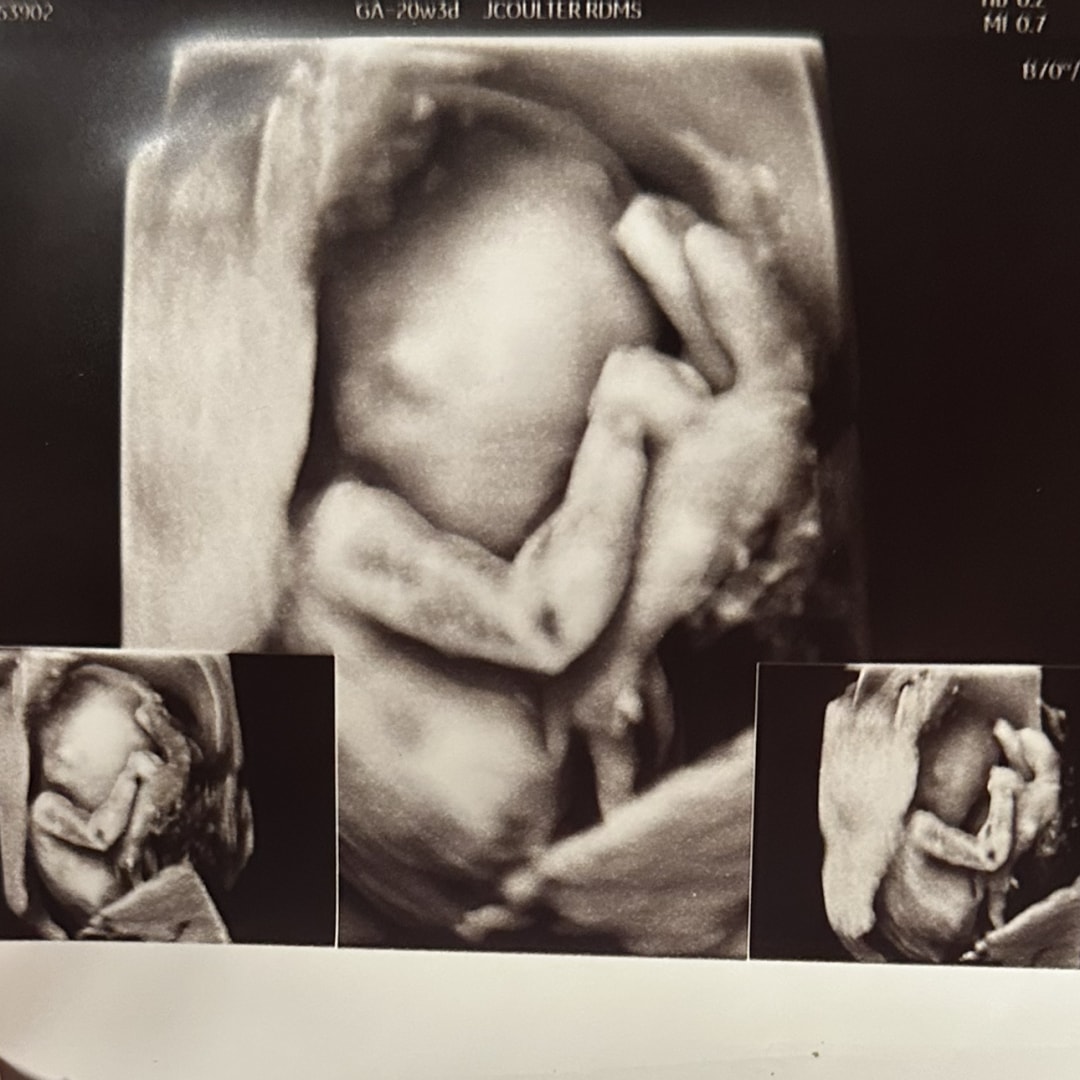 Photo shared by Ashlee for their Babylist baby registry.