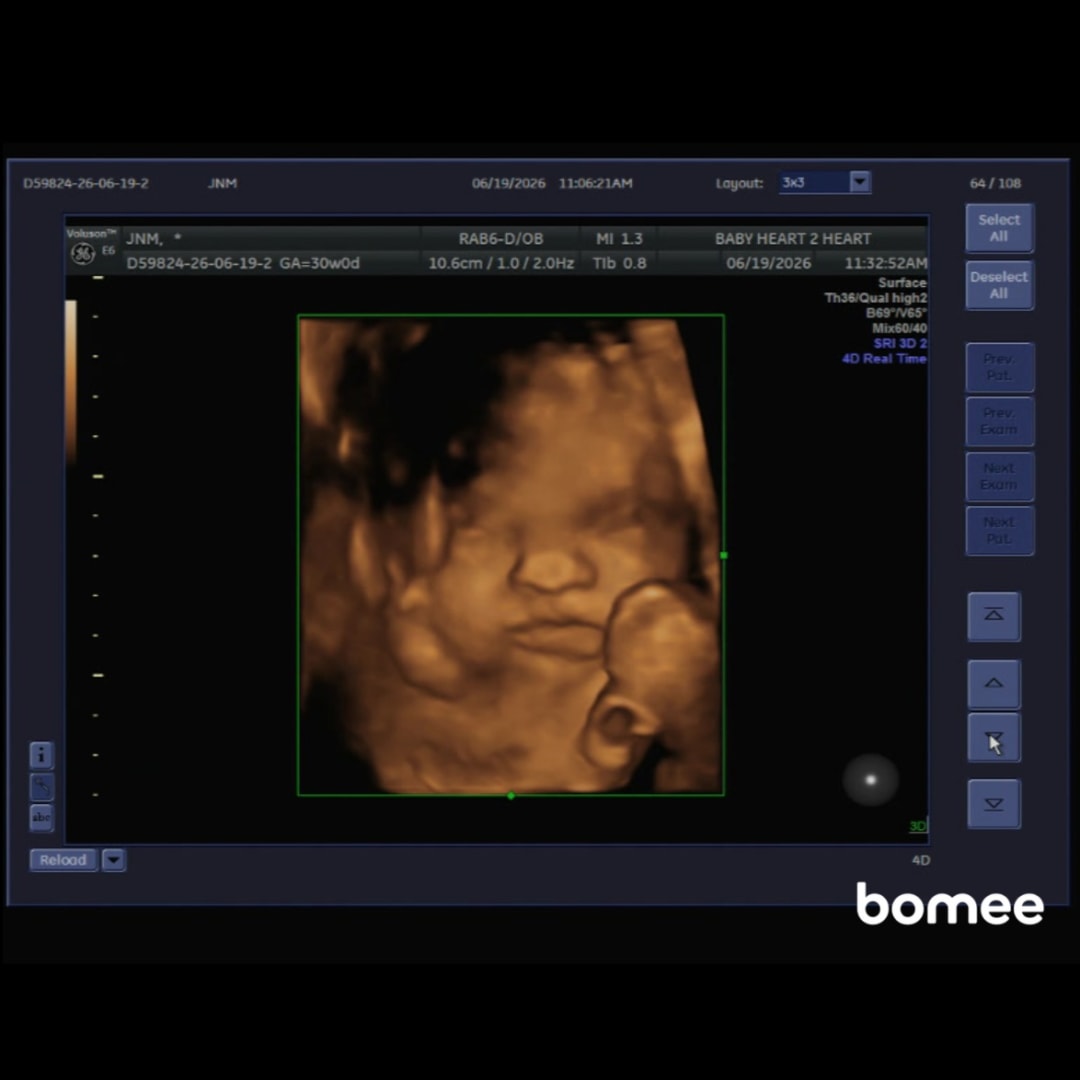Photo shared by Jaycee for their Babylist baby registry.