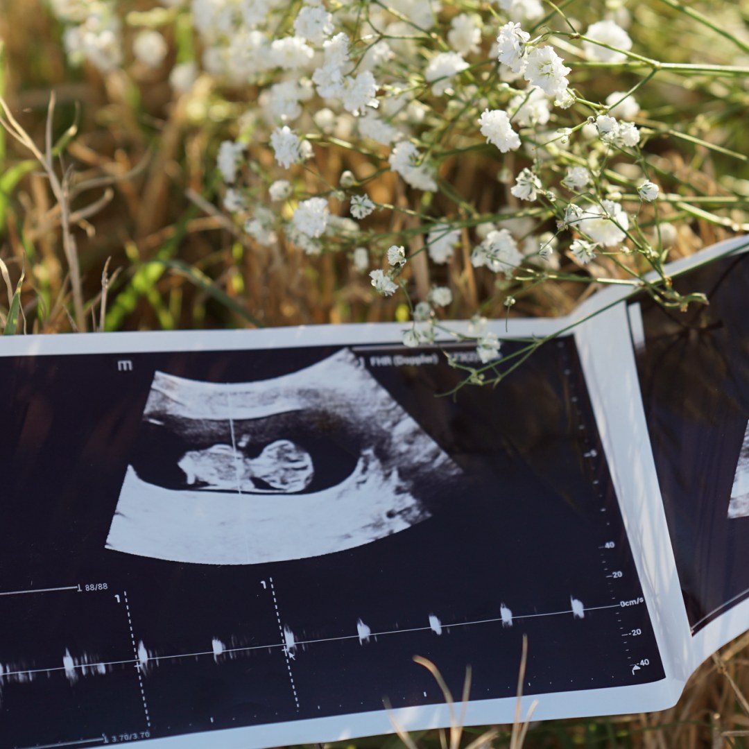 Photo shared by Jazmine for their Babylist baby registry.