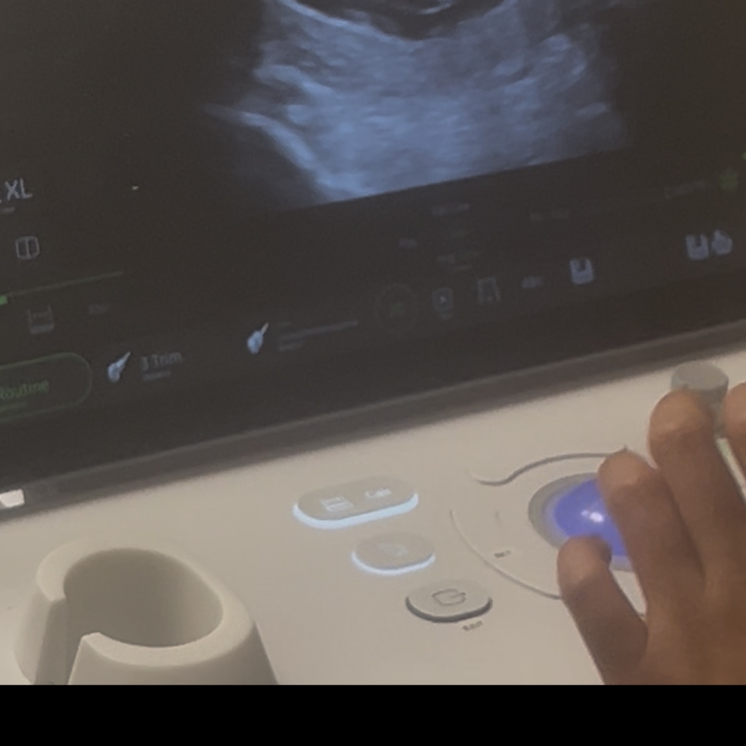 Photo shared by Michelle for their Babylist baby registry.