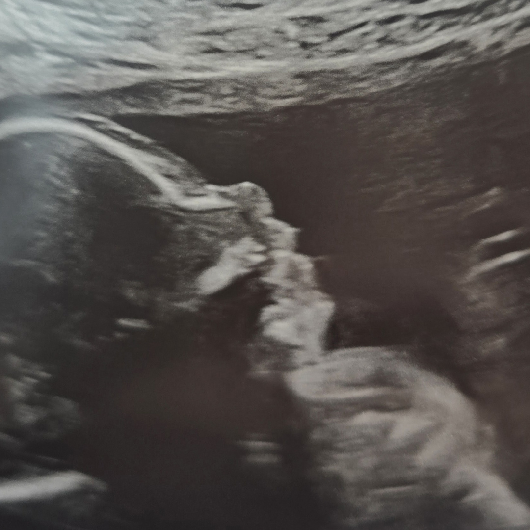 Photo shared by Candice for their Babylist baby registry.