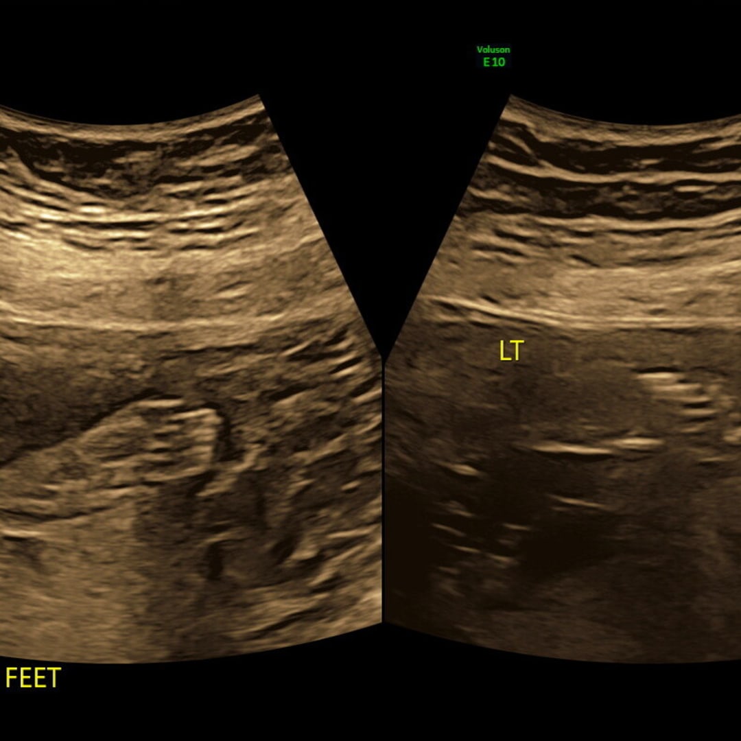 Photo shared by Tanala for their Babylist baby registry.