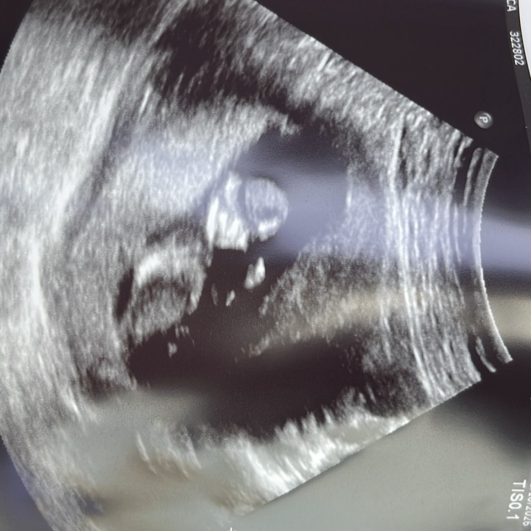 Photo shared by Angelica for their Babylist baby registry.