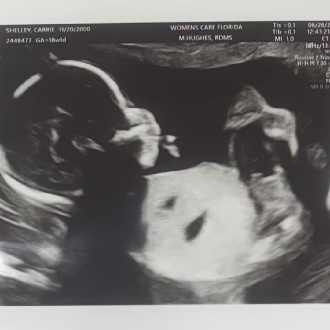Photo shared by Carrie for their Babylist baby registry.