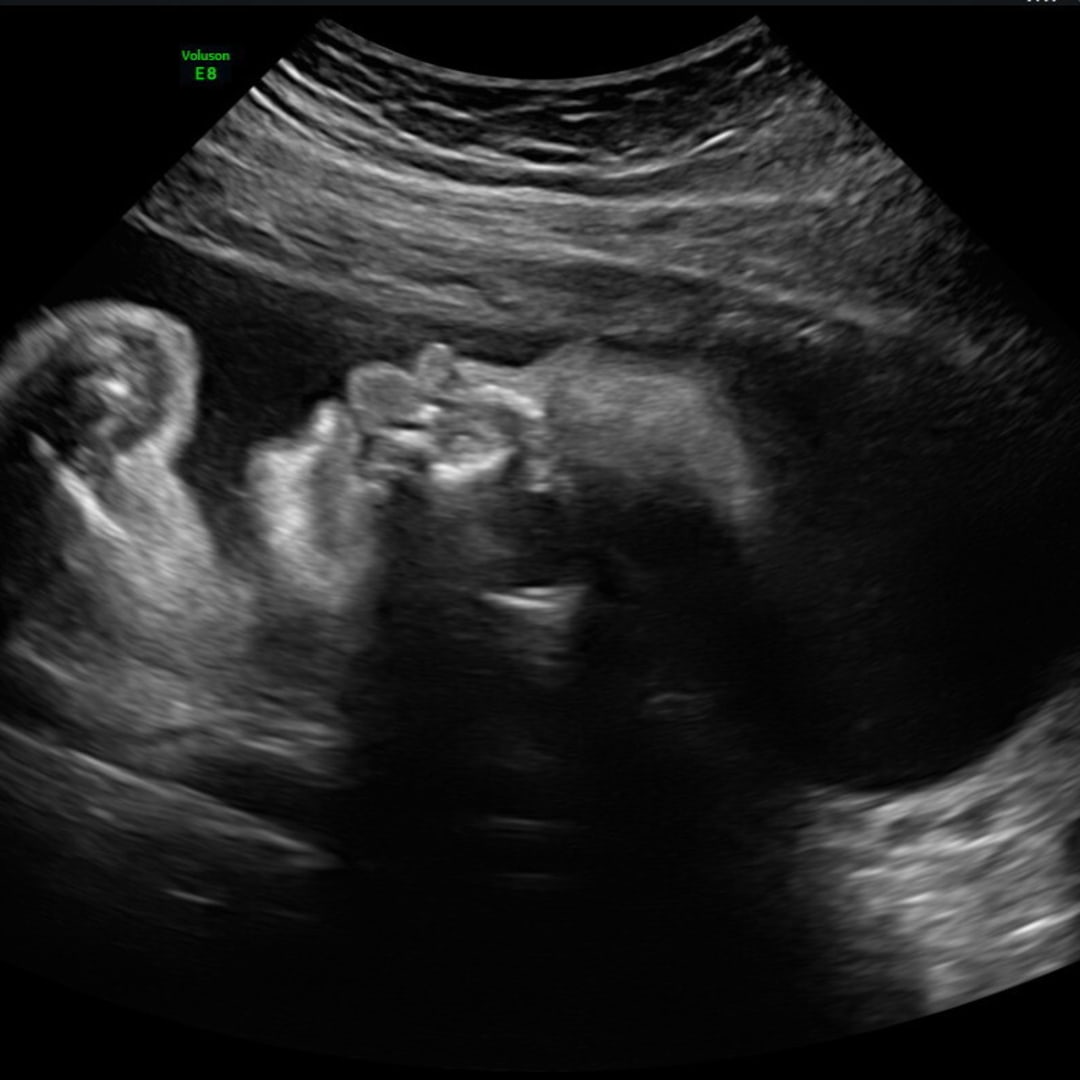 Photo shared by Aryanna for their Babylist baby registry.