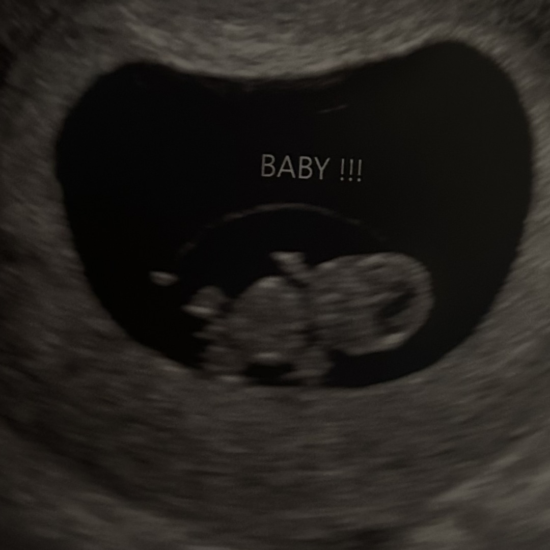 Photo shared by Zariah for their Babylist baby registry.