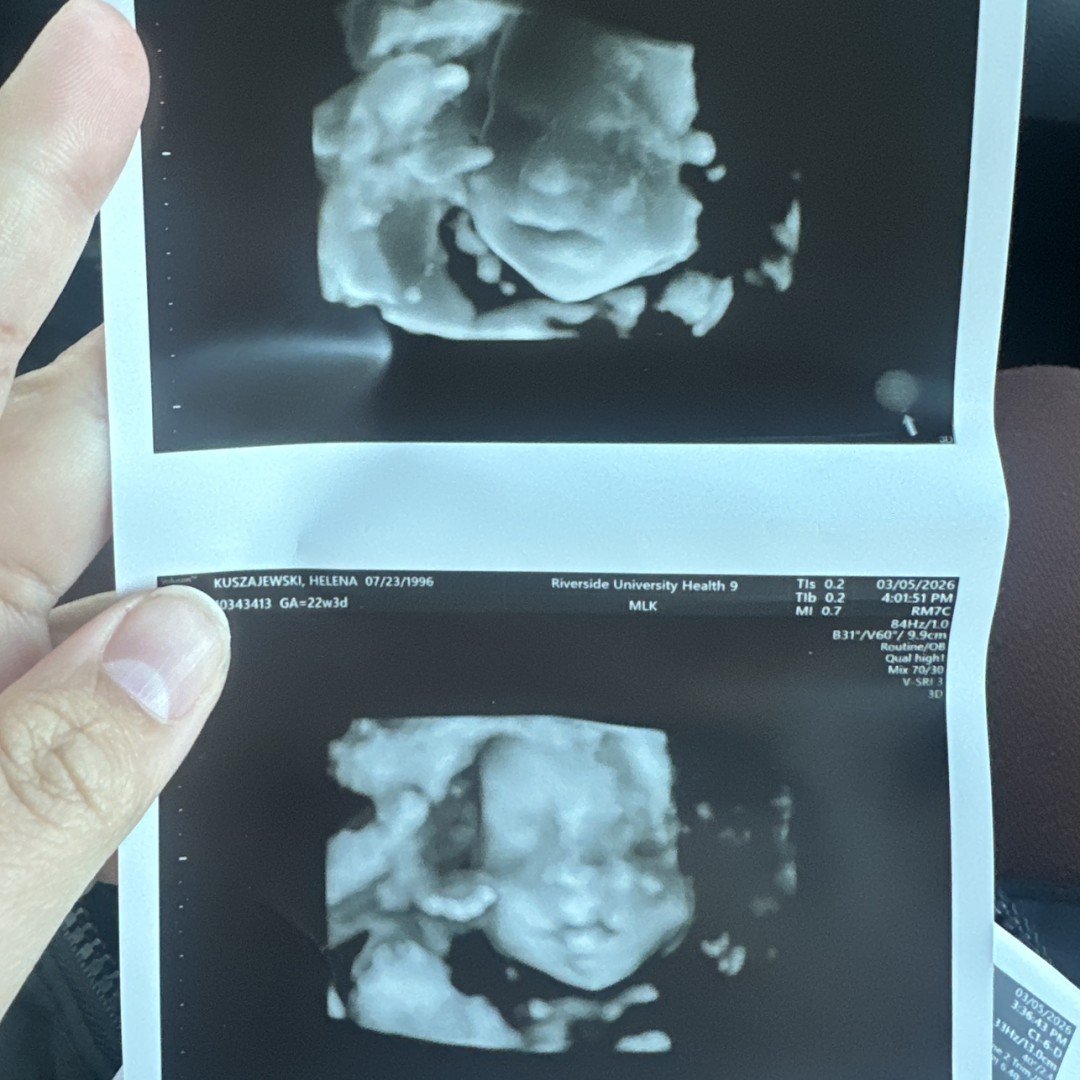Photo shared by Anne-Marie for their Babylist baby registry.
