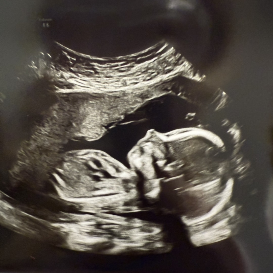 Photo shared by Sarah for their Babylist baby registry.