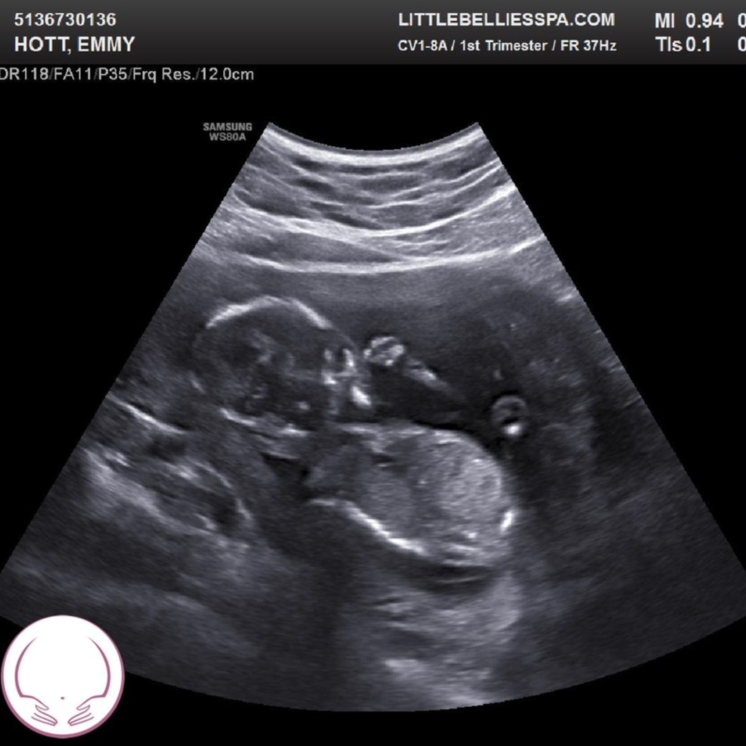 Photo shared by Emmy for their Babylist baby registry.