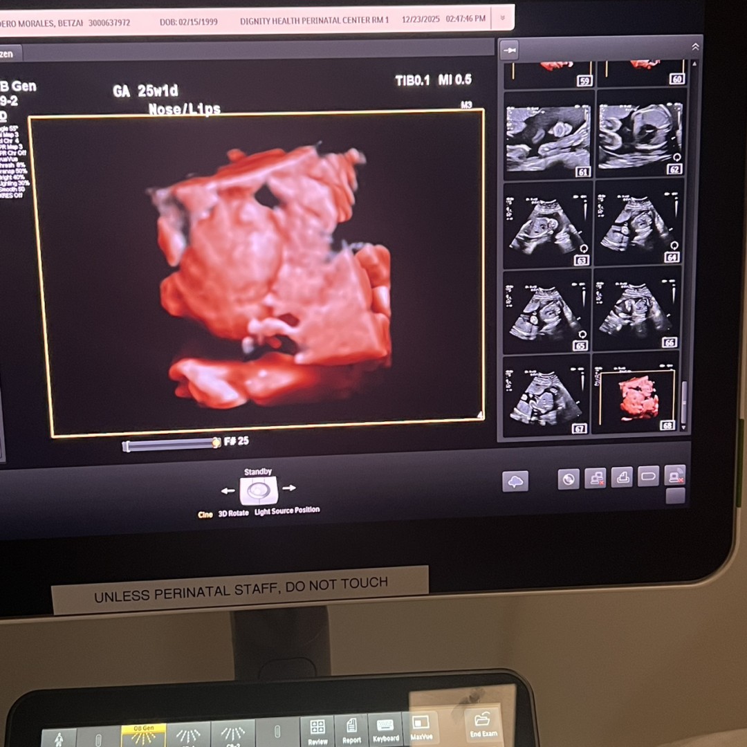 Photo shared by Betzahira for their Babylist baby registry.