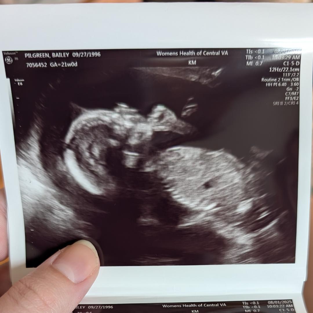 Photo shared by Bailey for their Babylist baby registry.