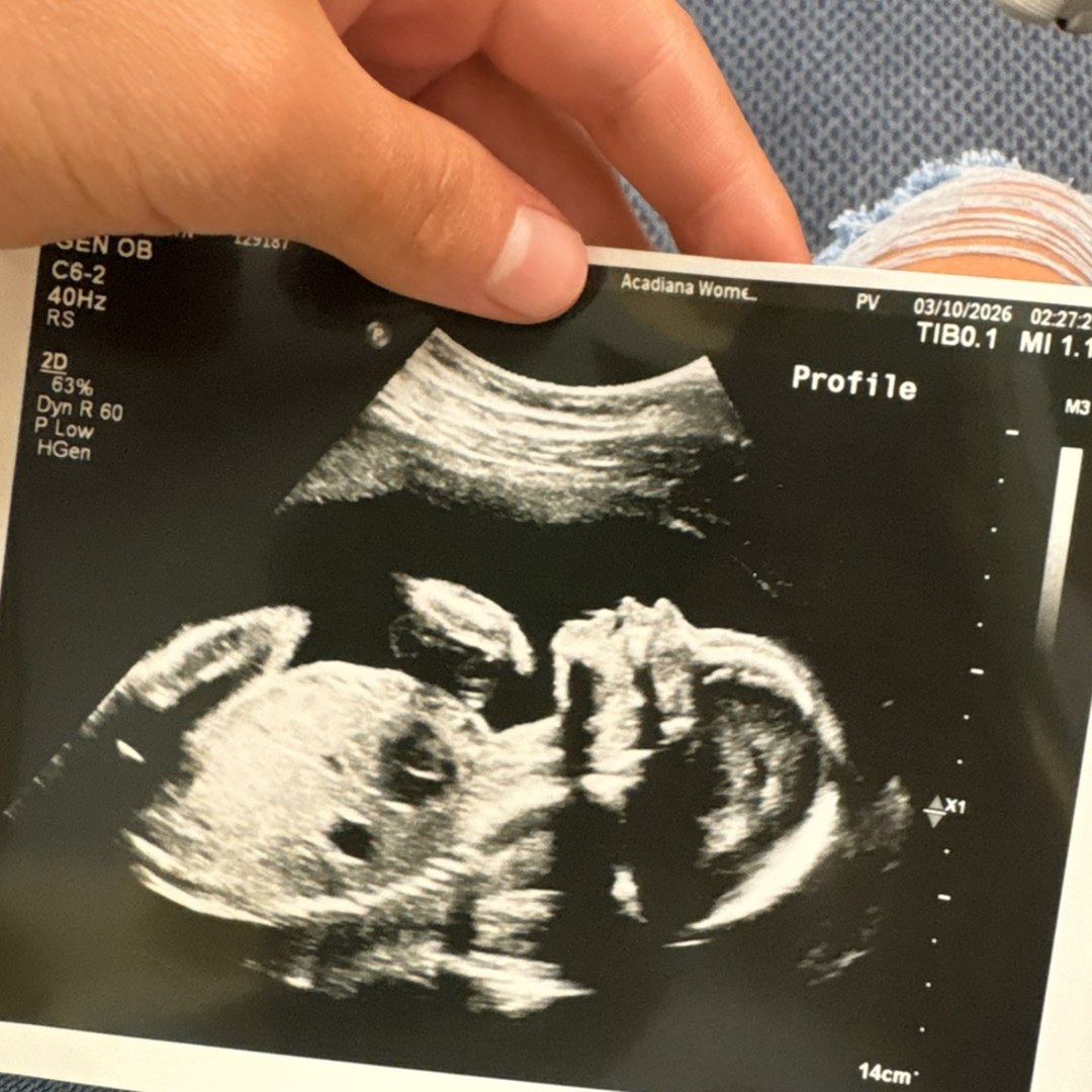 Photo shared by Addisyn for their Babylist baby registry.