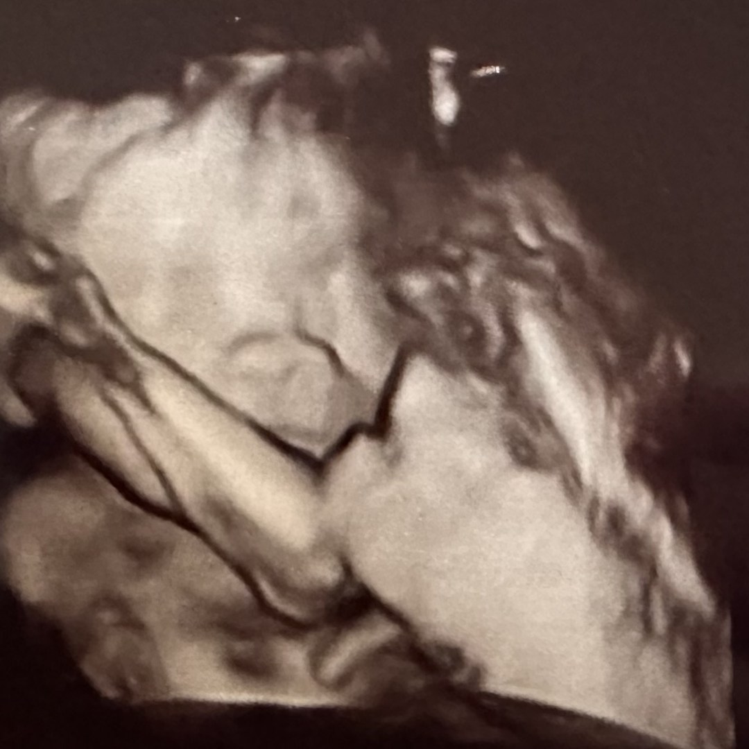Photo shared by Dominika for their Babylist baby registry.