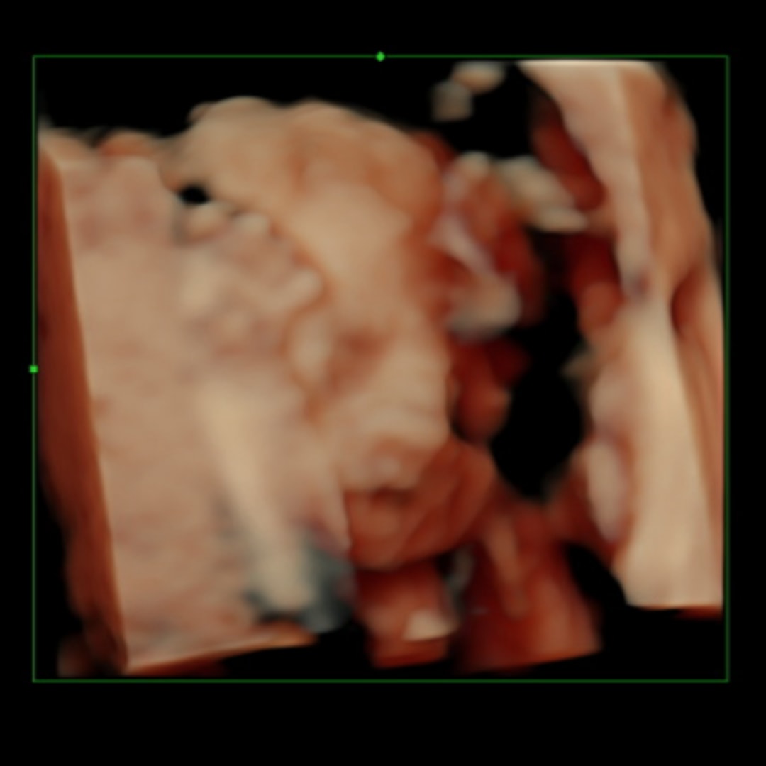 Photo shared by Brooke for their Babylist baby registry.