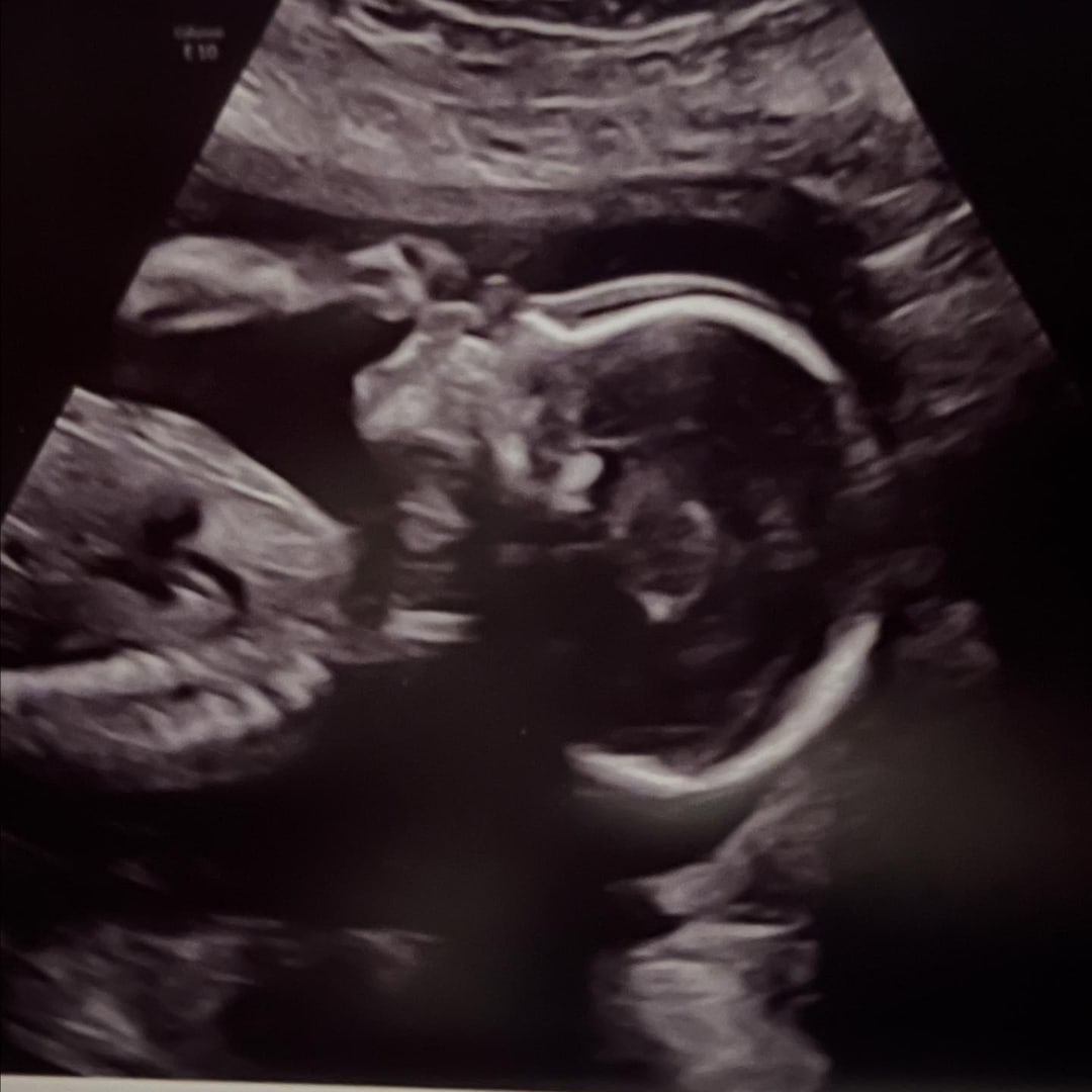 Photo shared by Bailey for their Babylist baby registry.