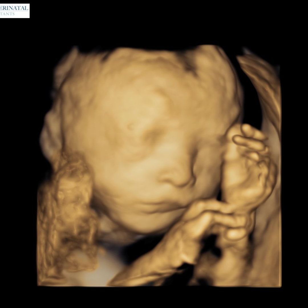 Photo shared by Maria for their Babylist baby registry.