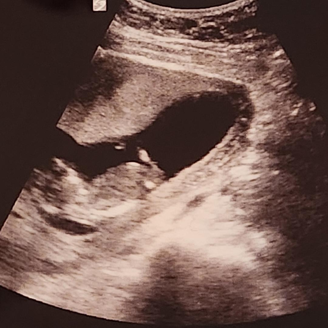 Photo shared by Melina for their Babylist baby registry.