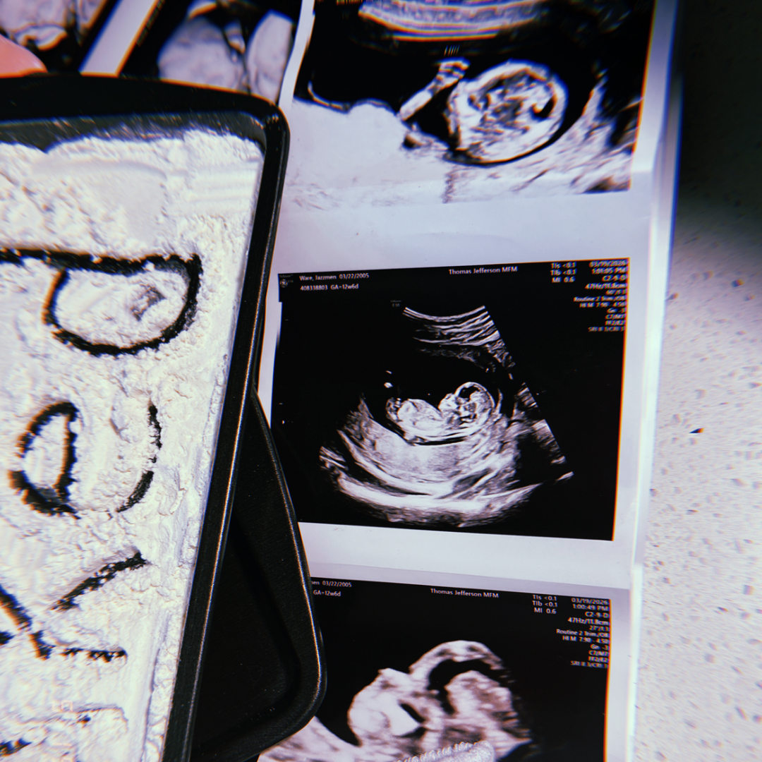 Photo shared by Jazzmen for their Babylist baby registry.