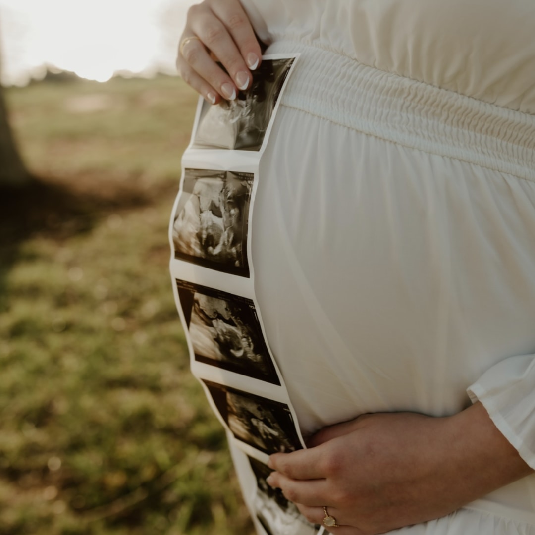 Photo shared by Madison for their Babylist baby registry.