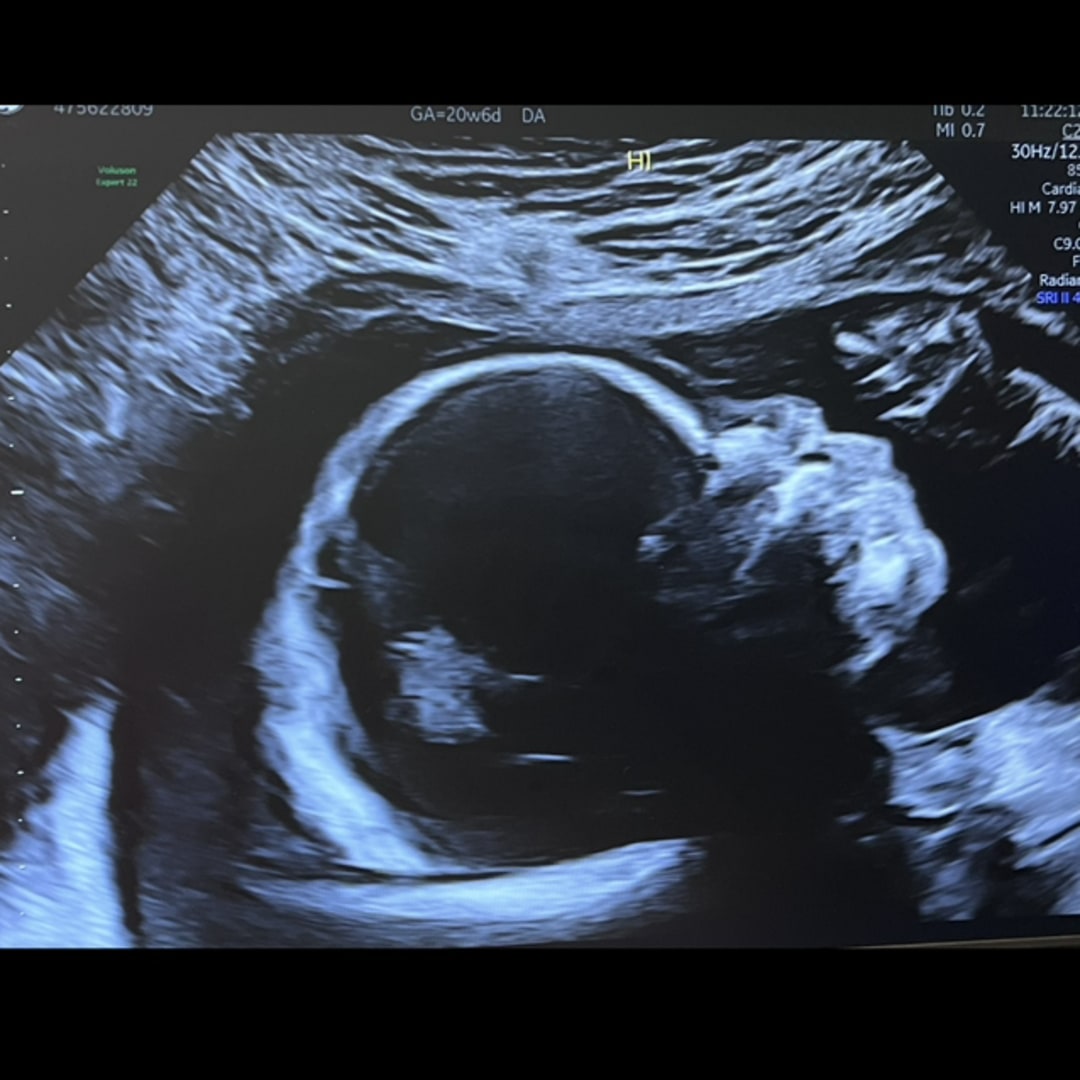 Photo shared by Antionette for their Babylist baby registry.