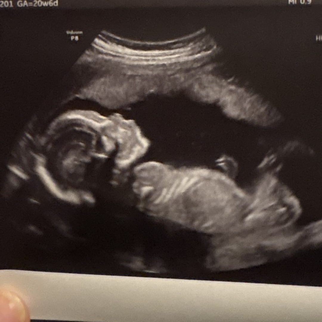 Photo shared by Stephanie for their Babylist baby registry.