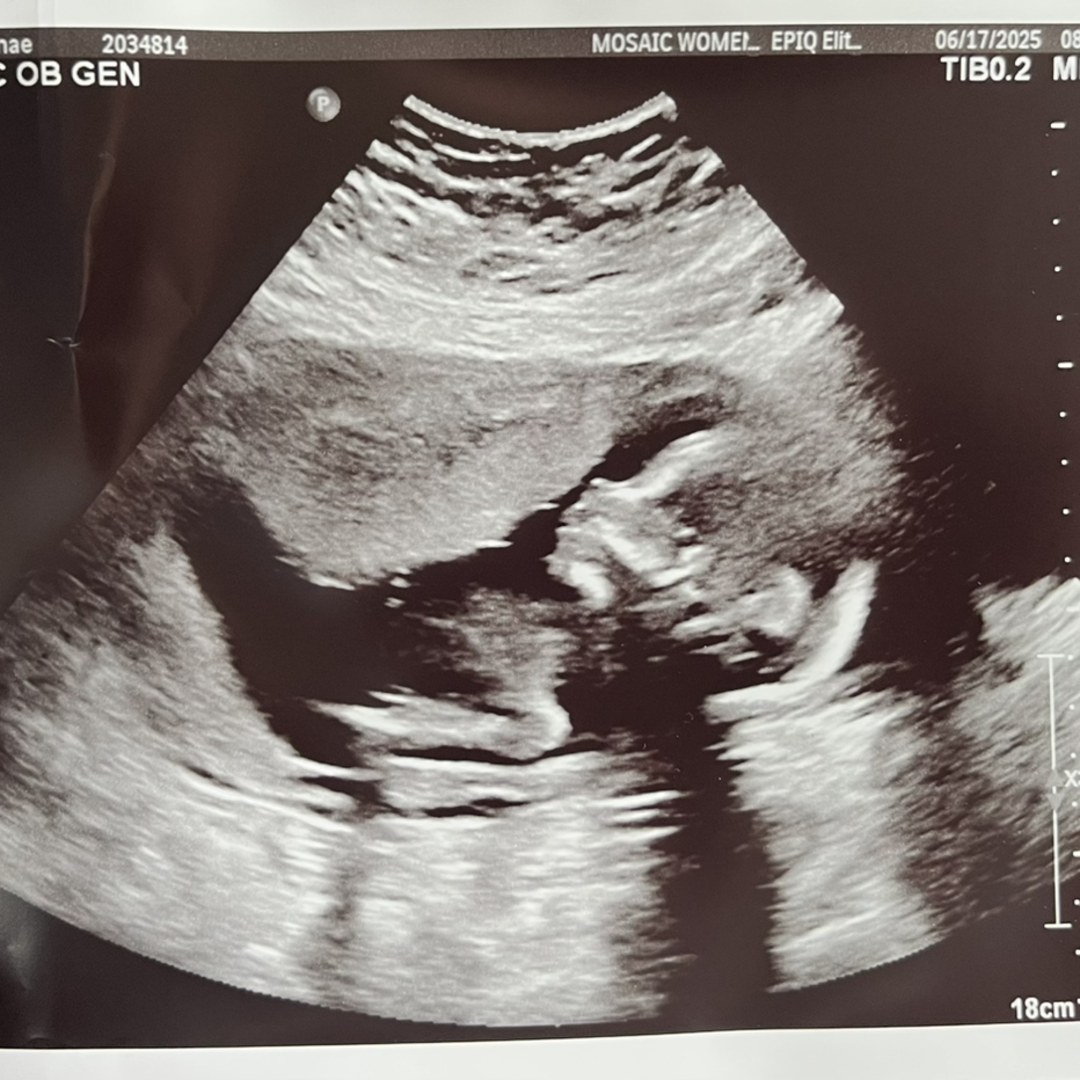 Photo shared by Simonae for their Babylist baby registry.