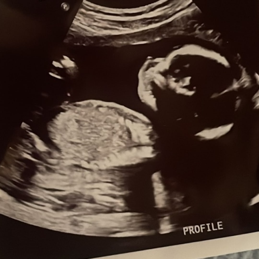 Photo shared by Emmma for their Babylist baby registry.