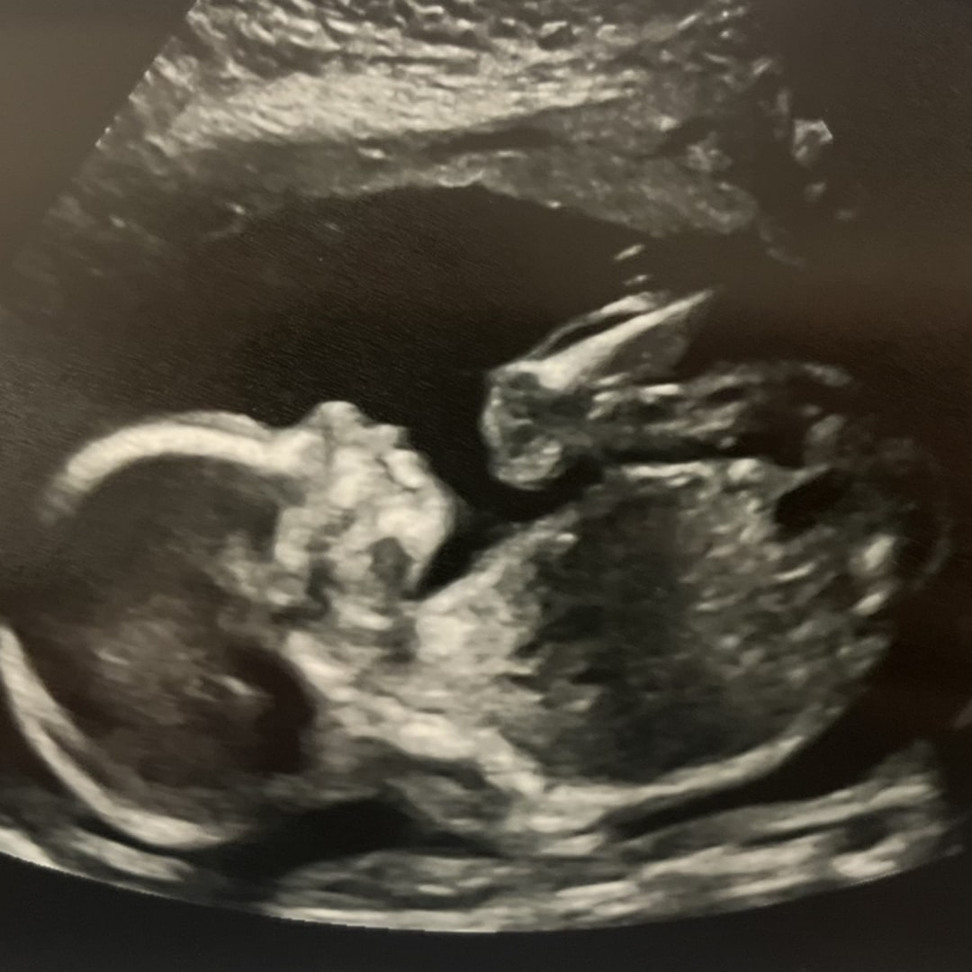 Photo shared by Hannah for their Babylist baby registry.