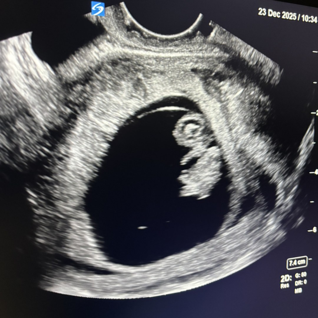 Photo shared by Hailey for their Babylist baby registry.