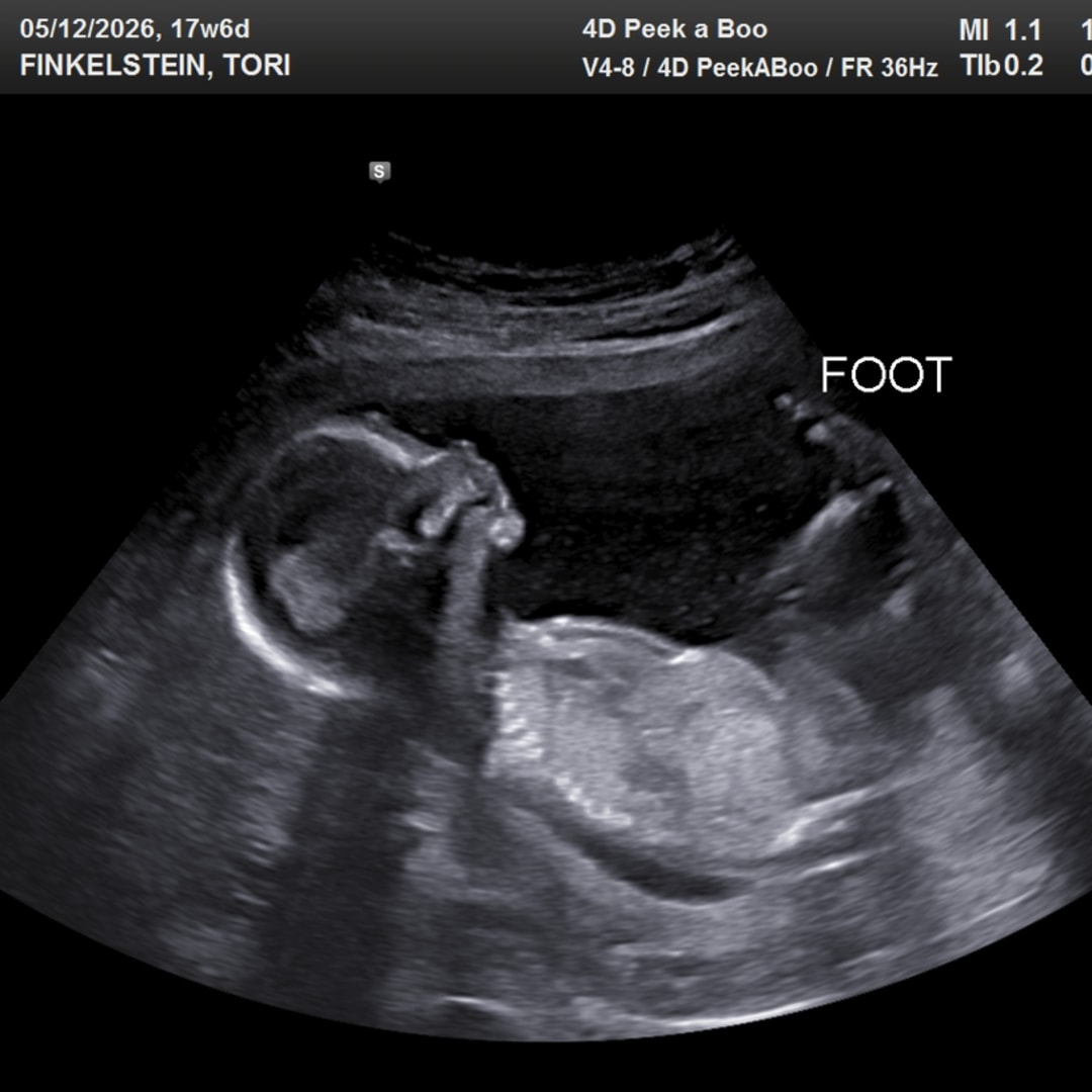 Photo shared by Tori for their Babylist baby registry.