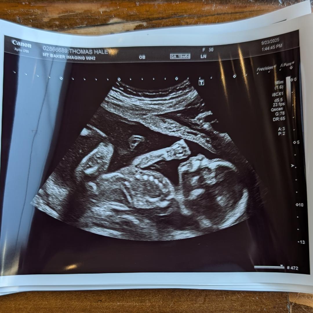 Photo shared by Haley for their Babylist baby registry.