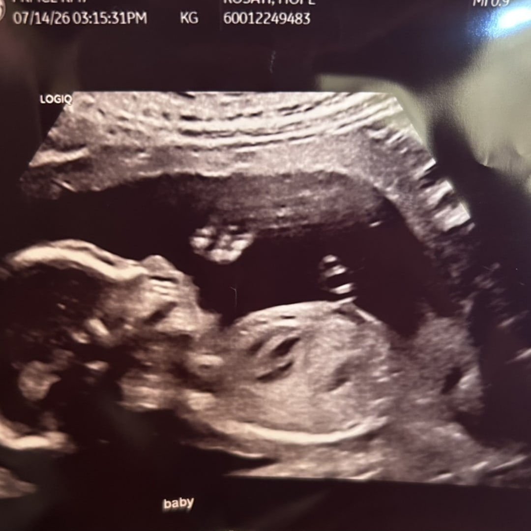 Photo shared by Anela for their Babylist baby registry.