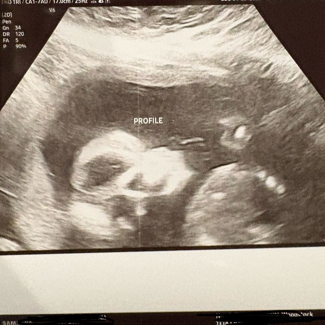 Photo shared by Taylor for their Babylist baby registry.