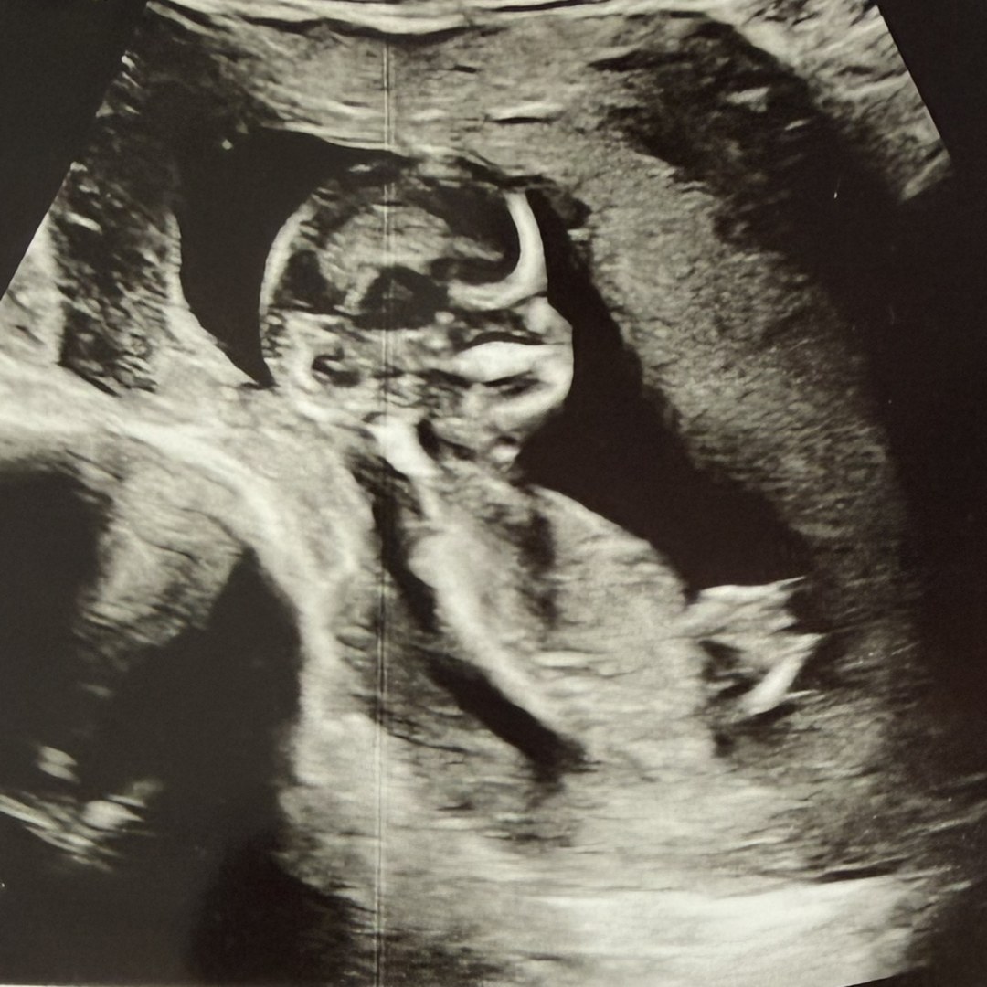 Photo shared by Gillian for their Babylist baby registry.